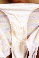 ATK hairy  in exotic and hairy