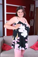 ATK hairy  in mature and hairy