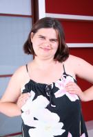 ATK hairy  in mature and hairy