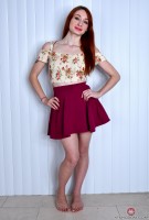 ATK hairy  in young and hairy