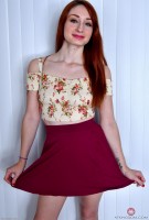 ATK hairy  in young and hairy