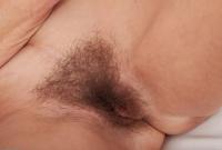 ATK hairy  in mature and hairy
