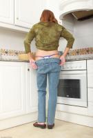 ATK hairy  in mature and hairy