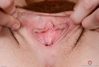 ATK hairy  in young and hairy