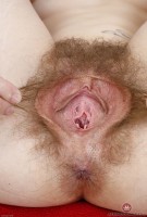 ATK hairy  in young and hairy