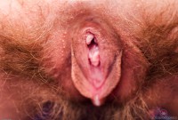 ATK hairy  in young and hairy