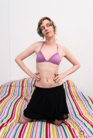 ATK hairy  in young and hairy