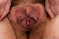 ATK hairy  in young and hairy