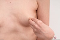 ATK hairy  in young and hairy