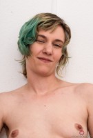 ATK hairy  in young and hairy