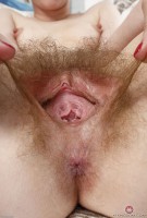 ATK hairy  in young and hairy