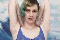 ATK hairy  in young and hairy