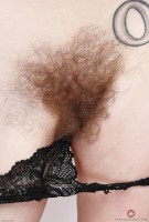 ATK hairy  in young and hairy