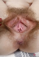 ATK hairy  in young and hairy