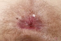 ATK hairy Mercy West Set