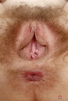 ATK hairy  in young and hairy