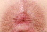 ATK hairy Mercy West in hairy fun