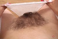 ATK hairy  in mature and hairy