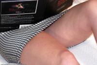 ATK hairy  in young and hairy