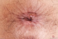 ATK hairy Mi Ha Doan Set