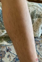 ATK hairy  in exotic and hairy