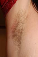 ATK hairy  in young and hairy