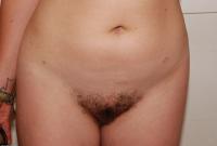 ATK hairy  in young and hairy