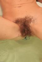 ATK hairy  in young and hairy
