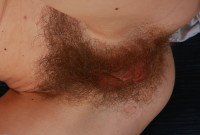 ATK hairy Mika A Set