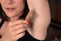 ATK hairy  in mature and hairy