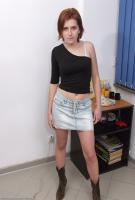 ATK hairy  in young and hairy