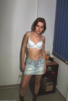 ATK hairy  in young and hairy