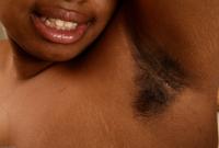 ATK hairy  in exotic and hairy