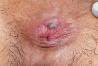 ATK hairy Nari Park Set