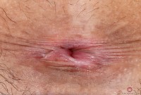 ATK hairy Nari Park Set