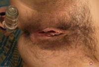ATK hairy  in young and hairy