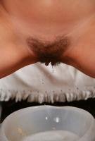 ATK hairy  in young and hairy