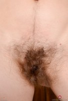 ATK hairy  in mature and hairy