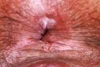 ATK hairy Natasha Kaur Set