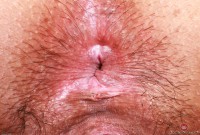 ATK hairy  in scary hairy