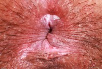 ATK hairy  in scary hairy