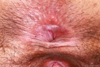 ATK hairy Natasha Kaur Set