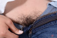ATK hairy  in young and hairy