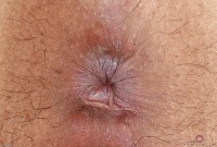 ATK hairy Nenetl Avril Set