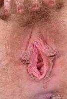 ATK hairy  in young and hairy