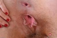 ATK hairy  in young and hairy