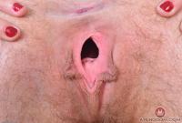 ATK hairy  in young and hairy