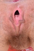 ATK hairy  in young and hairy