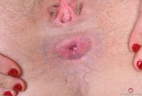 ATK hairy  in young and hairy