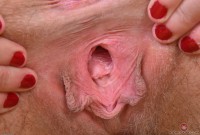 ATK hairy  in young and hairy